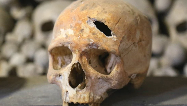 A smashed skull discovered at the Holy Trinity Church