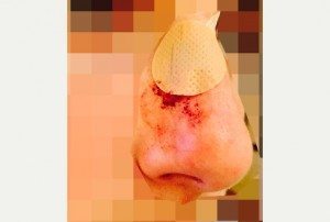 nose